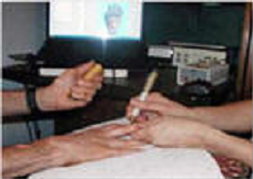 Electro Dermal Screening